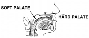 The palate is the roof of the mouth. The front of the roof is the hard palate, and the rear of the roof (towards the back of the throat) is where the soft palate is located.